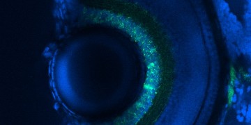 Image of developing Zebrafish eye
